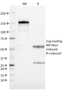 CD19 Antibody (CVID3/155), Novus Biologicals 0.2mg; Unlabeled:Antibodies,